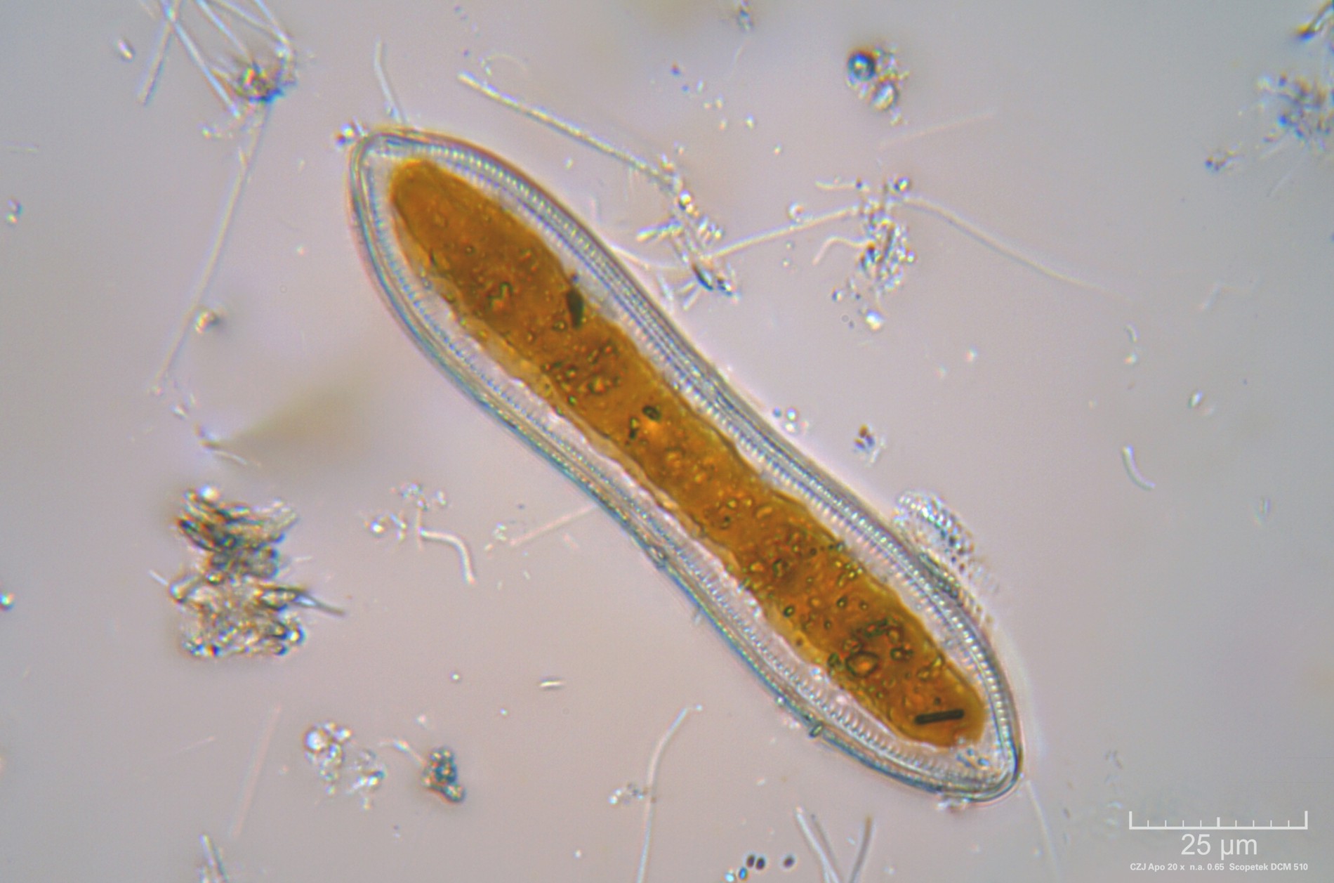 Diatomea - Cymatopleura solea